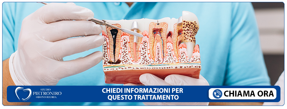 endodonzia-trattamento-endodontico Roma