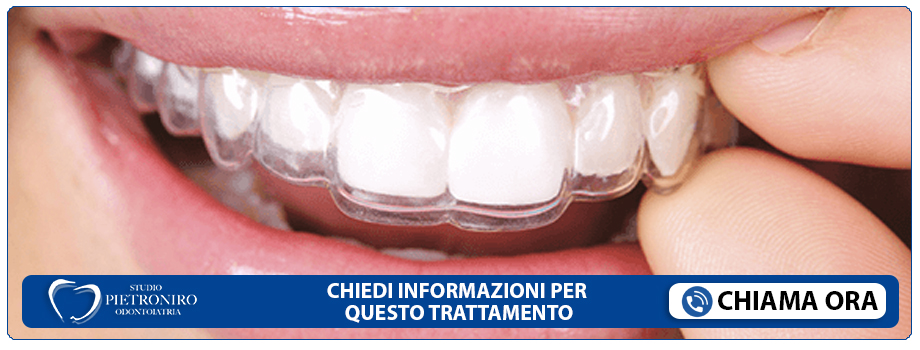 ortodonzia-invisalign Roma